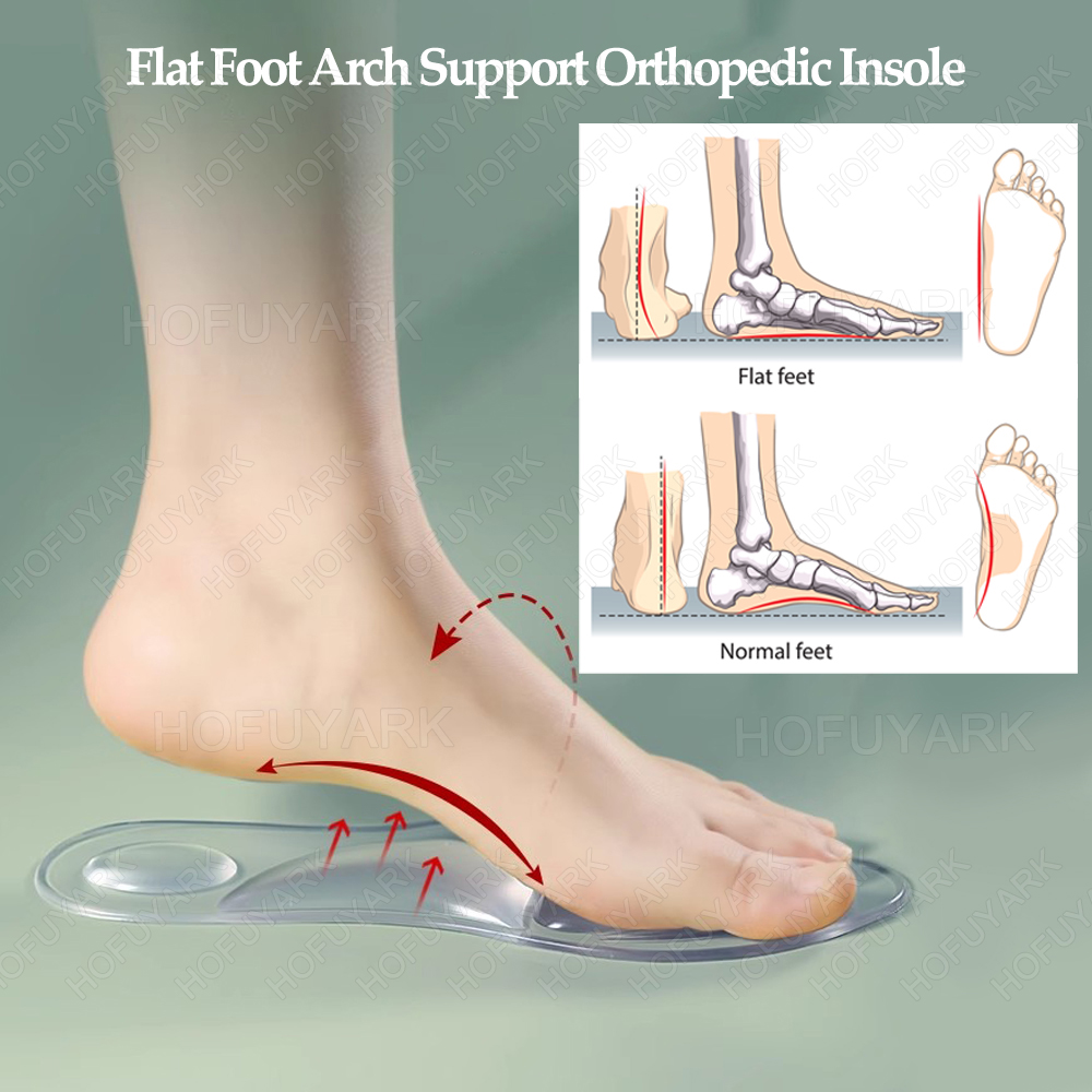 Sol Gel Silikon Sol Plantar Fa - Women'S Shoes For Plantar Fasciitis ulasan dan harga